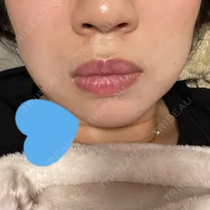 BiBiクリニック口コミ