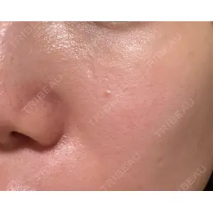 クレオビューティークリニック口コミ