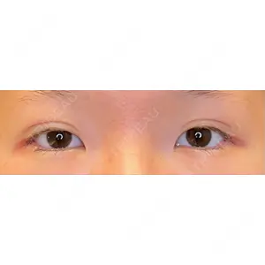 LOUIS CLINIC 二子玉川院【ルイクリニック】口コミ