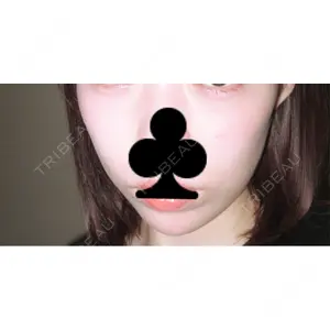 HAAB×DREAM BEAUTY CLINIC 東京本院の
