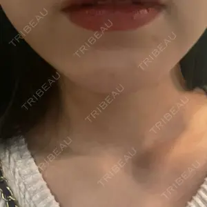 エースクリニック エースクリニック 大阪梅田HEPナビオ院口コミ