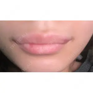 ルラ美容クリニック ルラ美容クリニック 高田馬場院口コミ