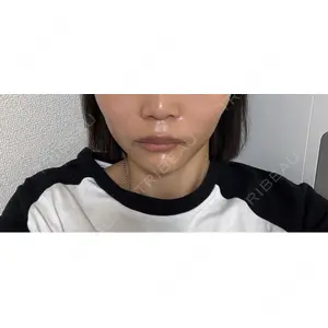 プロクリニック PRO CLINIC プロクリニック 銀座院口コミ