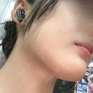 plume clinic plume clinic口コミ