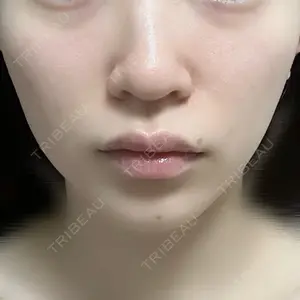 CZEN CLINIC 銀座院口コミ