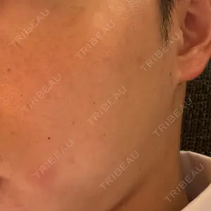 おおかみ美容のクリニック おおかみ美容のクリニック 新宿院口コミ