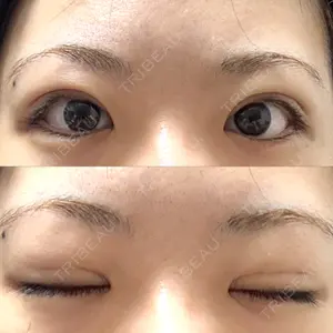 MIYAフェイスクリニック口コミ