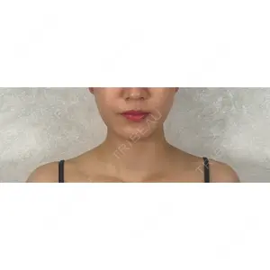 アリエル美容クリニック アリエル美容クリニック 横浜院口コミ