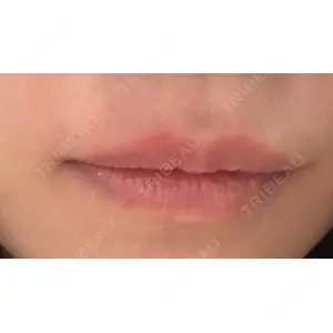 新未来クリニック口コミ