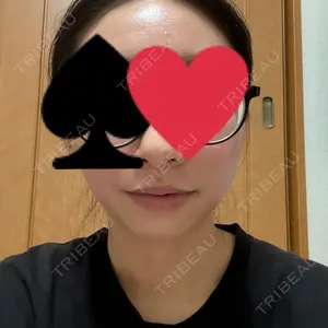 APスキンクリニック銀座口コミ