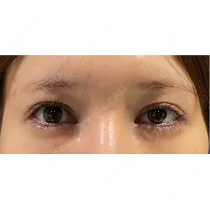 BIANCA CLINIC BIANCA銀座口コミ