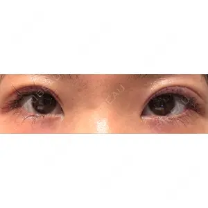 BIANCA CLINIC BIANCA銀座口コミ