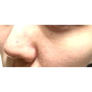 銀座TMクリニック口コミ