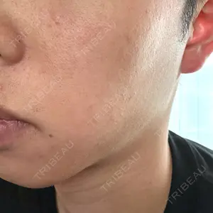 おおかみ美容のクリニック おおかみ美容のクリニック 新宿院口コミ