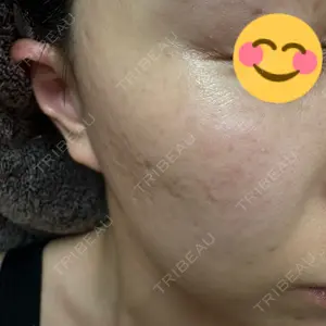 L‘amour clinic Tokyo【ラムールクリニック東京】口コミ