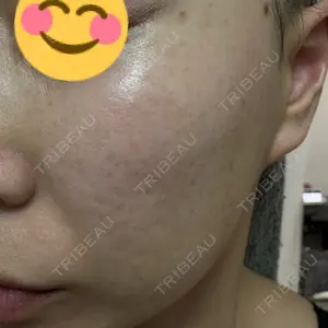 L‘amour clinic Tokyo【ラムールクリニック東京】口コミ