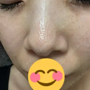 L‘amour clinic Tokyo【ラムールクリニック東京】口コミ