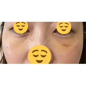 プラストクリニック口コミ