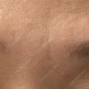 TCB東京中央美容外科 TCB東京中央美容外科 渋谷西口院口コミ