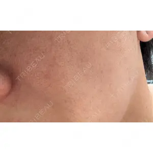 ON-CLINIC Beauty口コミ