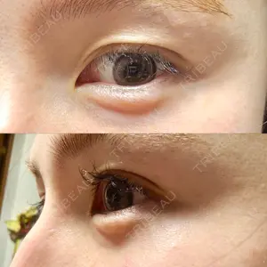 アリエル美容クリニック アリエル美容クリニック 横浜院口コミ