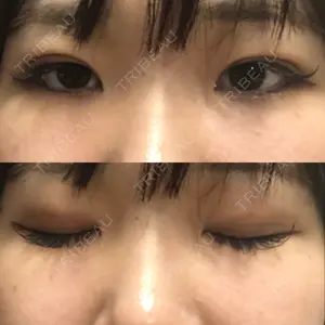 口コミ