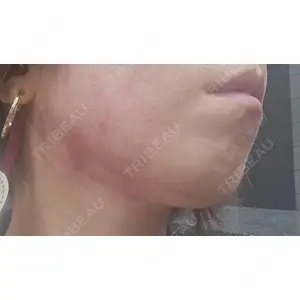 ゆきスキンクリニック 東池袋口コミ