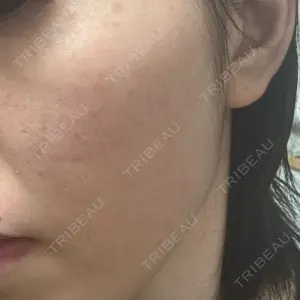 ミニマムスキンクリニック ミニマムスキンクリニック池袋口コミ