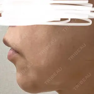 椿クリニック 椿クリニック 心斎橋院口コミ