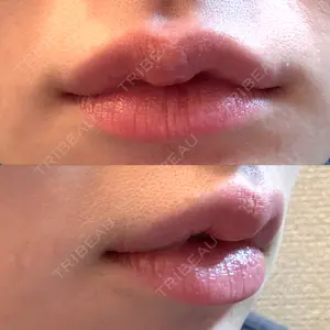 アリエル美容クリニック アリエル美容クリニック 横浜院口コミ