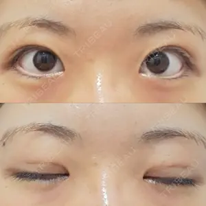 MIYAフェイスクリニック口コミ