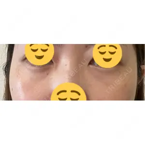 プラストクリニック口コミ