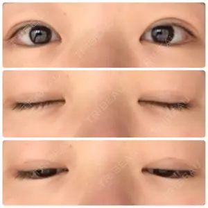 湘南美容クリニック 湘南美容クリニック 柏院口コミ