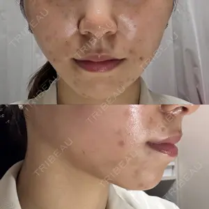 TCB東京中央美容外科 TCB東京中央美容外科 大宮東口院口コミ