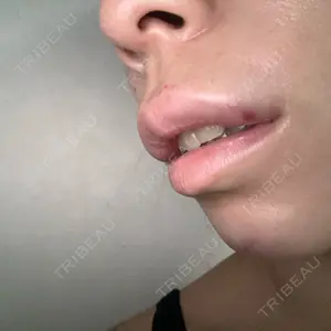 口コミ