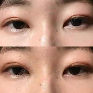 表参道スキンクリニック 表参道スキンクリニック 表参道院口コミ