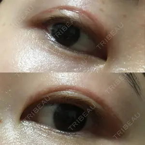 表参道スキンクリニック 表参道スキンクリニック 表参道院口コミ