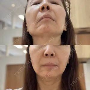 REDLINE CLINIC口コミ