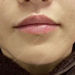 フィラークリニック フィラークリニック 大阪梅田院口コミ