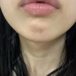 ルラ美容クリニック ルラ美容クリニック 池袋院口コミ