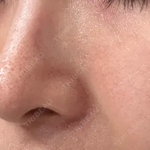 トラスト美容クリニック トラスト美容クリニック 銀座院口コミ