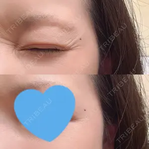 おおたかの森ビューティークリニック口コミ