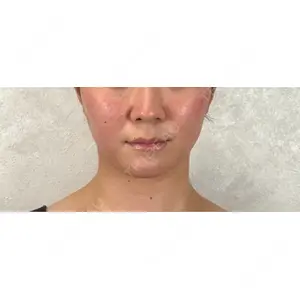 アリエル美容クリニック アリエル美容クリニック 横浜院口コミ