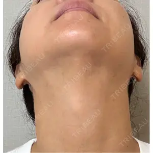 ゆきスキンクリニック 東池袋口コミ