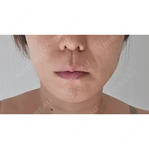 ゆきスキンクリニック 東池袋口コミ