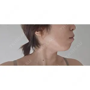 ゆきスキンクリニック 東池袋口コミ