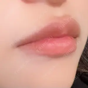 MKクリニック MKクリニック 日本橋院口コミ