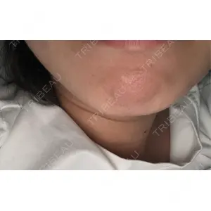 TCB東京中央美容外科 TCB東京中央美容外科 福岡博多院口コミ