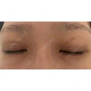 東京ココセランクリニック口コミ