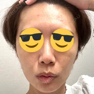 東京美容外科 東京美容外科 池袋院口コミ